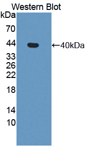 Polyclonal Antibody to Methylenetetrahydrofolate Reductase (MTHFR)