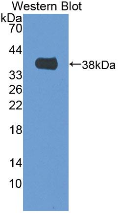 Polyclonal Antibody to Mitochondrial Methionyl tRNA Formyltransferase (MTFMT)