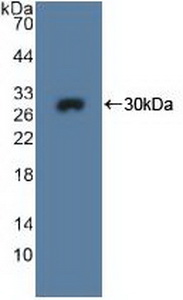 Polyclonal Antibody to N-Methylpurine DNA Glycosylase (MPG)