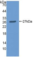 Polyclonal Antibody to Malic Enzyme 2, NADP+ Dependent, Mitochondrial (ME2)
