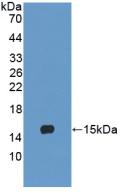 Polyclonal Antibody to Lymphocyte Antigen 96 (LY96)