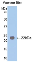 Polyclonal Antibody to Leucine Rich Repeat Kinase 2 (LRRK2)
