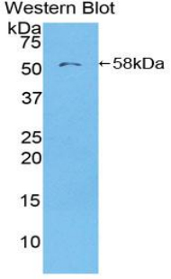 Polyclonal Antibody to Leucine Rich Repeat Kinase 2 (LRRK2)