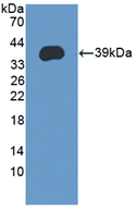Polyclonal Antibody to Liver Expressed Antimicrobial Peptide 2 (LEAP2)