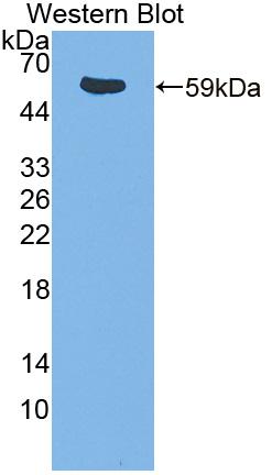 Polyclonal Antibody to IL2 Inducible T-Cell Kinase (ITK)