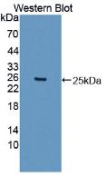 Polyclonal Antibody to Inter Alpha-Globulin Inhibitor H5 (ITIH5)