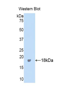 Polyclonal Antibody to Inter Alpha-Globulin Inhibitor H4 (ITIH4)