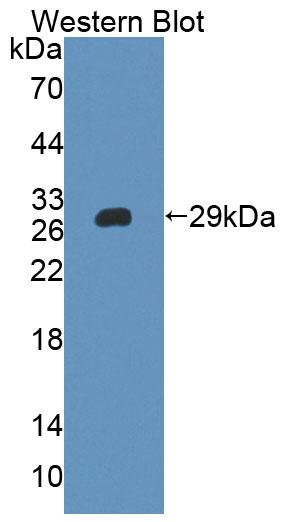 Polyclonal Antibody to Inter Alpha-Globulin Inhibitor H4 (ITIH4)