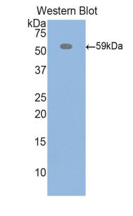 Polyclonal Antibody to Inter Alpha-Globulin Inhibitor H4 (ITIH4)