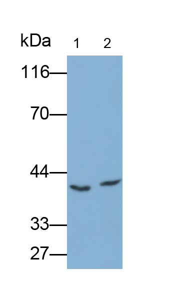 Polyclonal Antibody to Immunoglobulin Superfamily Containing Leucine Rich Repeat Protein (ISLR)