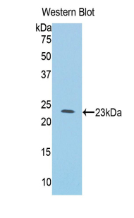 Polyclonal Antibody to Interleukin 1 Receptor Like Protein 1 (IL1RL1)