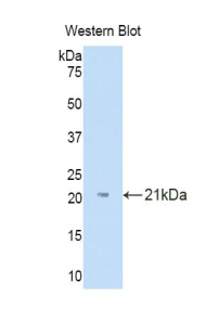 Polyclonal Antibody to Interleukin 18 Binding Protein (IL18BP)