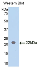 Polyclonal Antibody to Interleukin 18 Binding Protein (IL18BP)