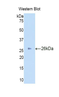 Polyclonal Antibody to Iduronate-2-Sulfatase (IDS)