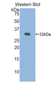 Polyclonal Antibody to Iduronate-2-Sulfatase (IDS)