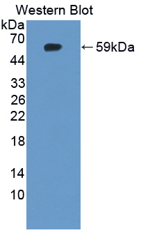 Polyclonal Antibody to Iduronate-2-Sulfatase (IDS)