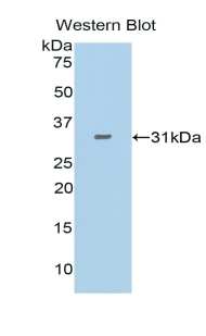 Polyclonal Antibody to Isocitrate Dehydrogenase 1, Soluble (IDH1)