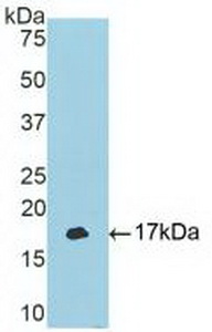 Polyclonal Antibody to T-Box Protein 3 (TBX3)