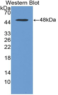 Polyclonal Antibody to Huntingtin (HTT)