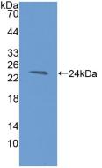 Polyclonal Antibody to Hepatitis A Virus Cellular Receptor 2 (HAVCR2)