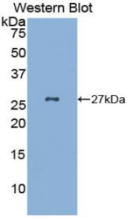 Polyclonal Antibody to Gastrokine 2 (GKN2)