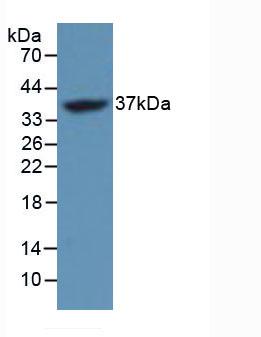 Polyclonal Antibody to FOS Like Antigen 1 (FOSL1)