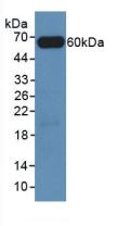 Polyclonal Antibody to FOS Like Antigen 1 (FOSL1)