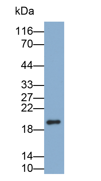 Polyclonal Antibody to Filaggrin (FLG)