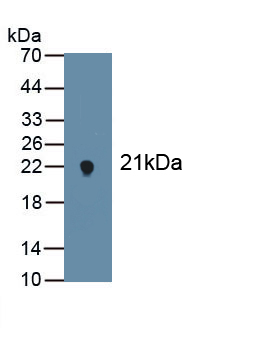 Polyclonal Antibody to Eosinophil Peroxidase (EPX)