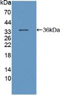 Polyclonal Antibody to Dynein, Axonemal, Heavy Chain 11 (DNAH11)