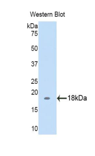 Polyclonal Antibody to Biglycan (BGN)