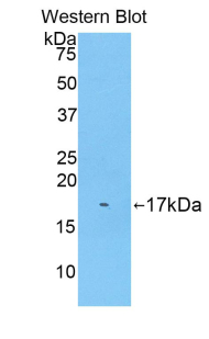 Polyclonal Antibody to Biglycan (BGN)