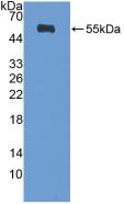Polyclonal Antibody to Diaphanous Homolog 1 (DIAPH1)