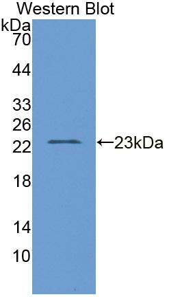 Polyclonal Antibody to D2-Hydroxyglutarate Dehydrogenase (D2HGDH)