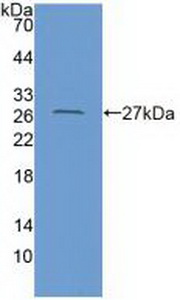 Polyclonal Antibody to Coxsackie Virus And Adenovirus Receptor (CXADR)