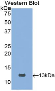 Polyclonal Antibody to Cystatin B (CSTB)