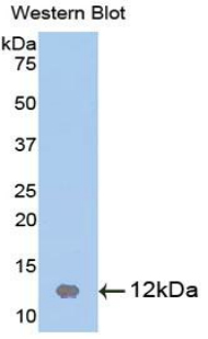 Polyclonal Antibody to Cystatin B (CSTB)