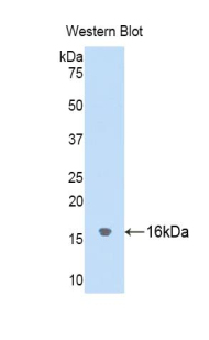 Polyclonal Antibody to Cystatin 2 (CST2)