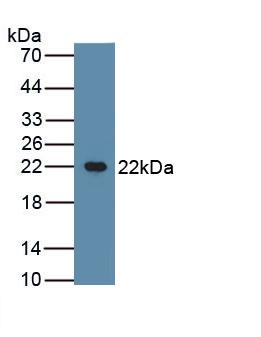 Polyclonal Antibody to Casein Beta (CSN2)