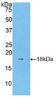 Polyclonal Antibody to Lecithin Cholesterol Acyltransferase (LCAT)