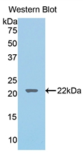 Polyclonal Antibody to Lecithin Cholesterol Acyltransferase (LCAT)