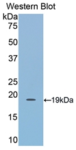 Polyclonal Antibody to Lecithin Cholesterol Acyltransferase (LCAT)