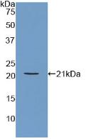 Polyclonal Antibody to Actin Related Protein 2/3 Complex Subunit 4 (ARPC4)