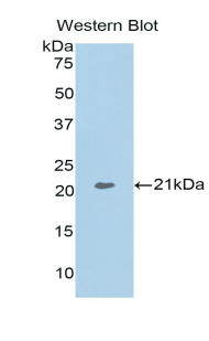 Polyclonal Antibody to Actin Related Protein 2/3 Complex Subunit 4 (ARPC4)