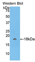 Polyclonal Antibody to Amelogenin, X-Linked (AMELX)