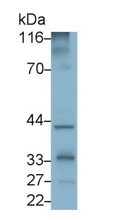 Polyclonal Antibody to Alpha-Methylacyl Coenzyme A Racemase (aMACR)