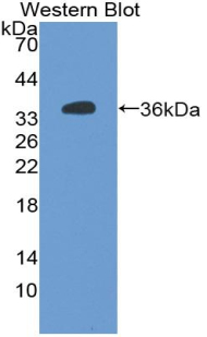 Polyclonal Antibody to Alkaline Phosphatase, Placental Like Protein 2 (ALPPL2)