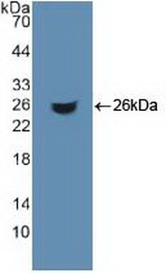 Polyclonal Antibody to Aconitase 1 (ACO1)