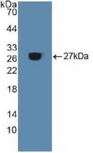 Polyclonal Antibody to Aconitase 1 (ACO1)