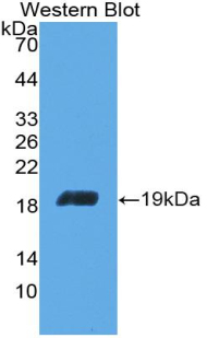 Polyclonal Antibody to Aconitase 1 (ACO1)